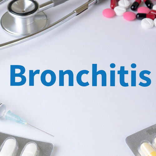 Bronchitis – Top Remedies and Management Options