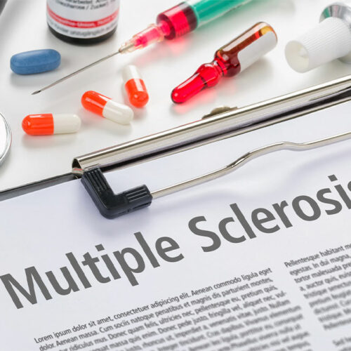 Multiple Sclerosis – Types, Diagnosis and Management Options