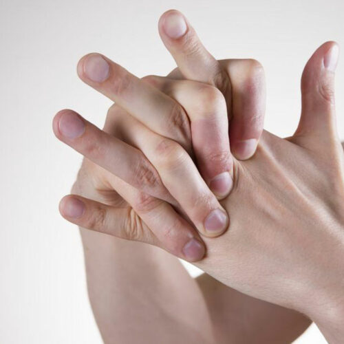 Here’s what you need to know about rheumatoid arthritis and lupus