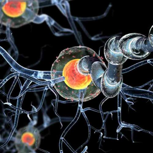 A Few Things to Know about Huntington’s Disease