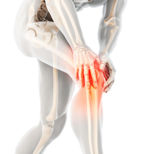 Osteoarthritis And Osteoporosis – Symptoms, Differences And Treatments