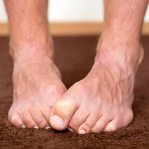 Neuropathy Foot Pain – Symptoms, Causes, Treatments and More