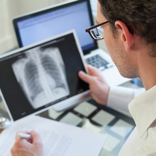 Pneumonia – Symptoms, Causes, Risk Factors, and Diagnosis