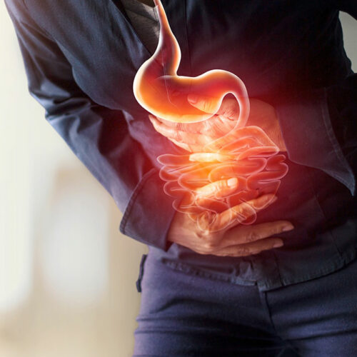 Understanding gastritis – A common stomach condition